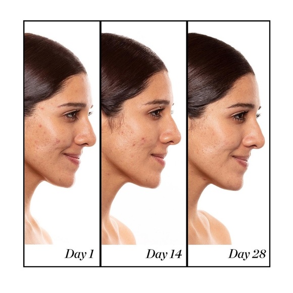 Sunday Riley A+ High-Dose Retinoid Serum – Anti-Aging Treatment for fine lines - Picture 7 of 7